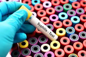 Syphilis test