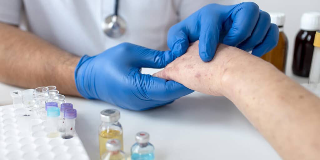 how to test for herpes