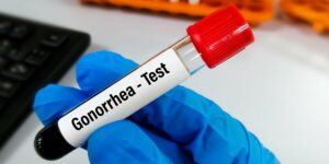 all about gonorrhea