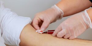 HIV viral load