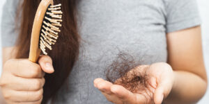 can an std cause hair loss