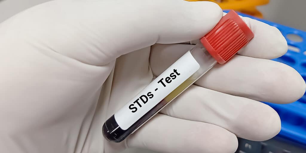 std test accuracy