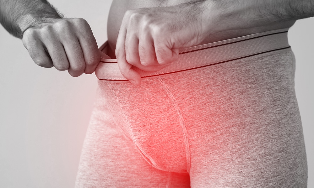 how to cure mens yeast infection