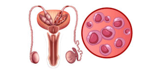 facts about chlamydia