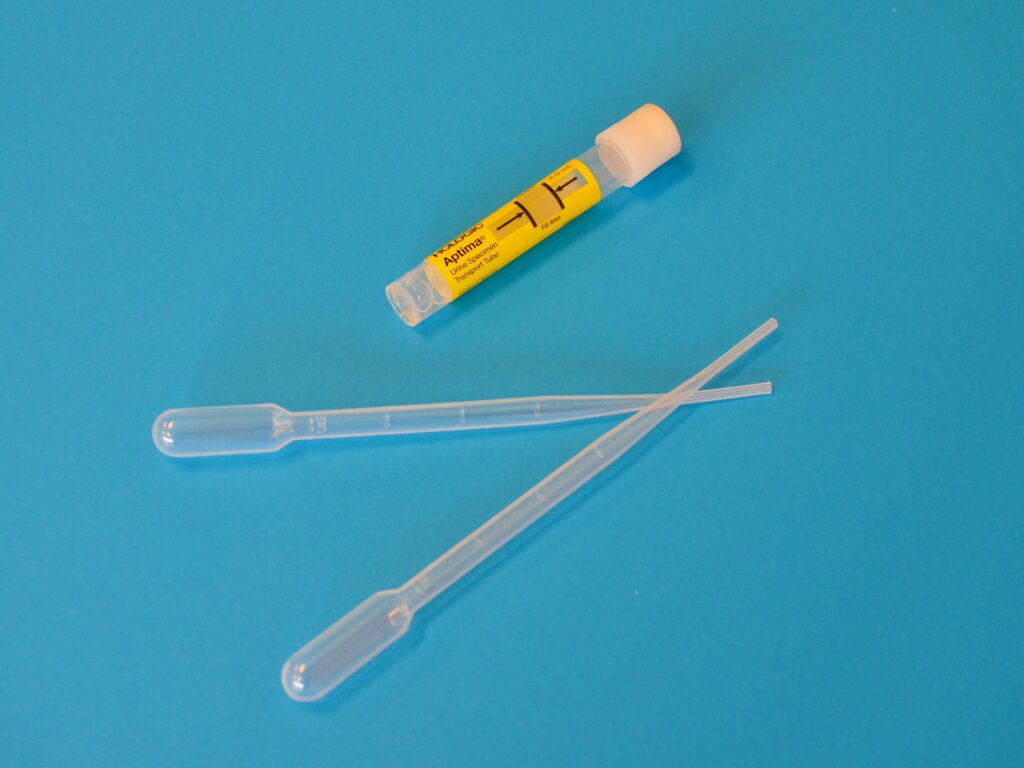 Urine test