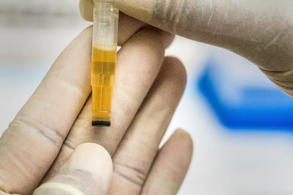 Urine test