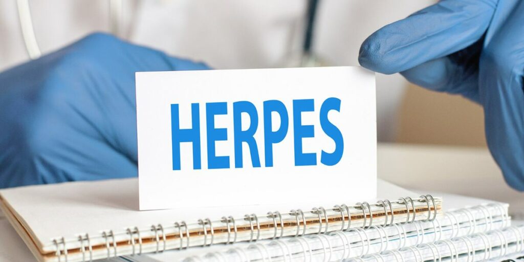 home remedies for genital herpes breakout