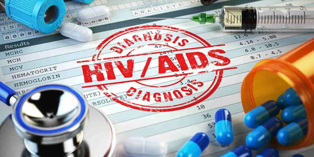 when does treatment of hiv typically begin