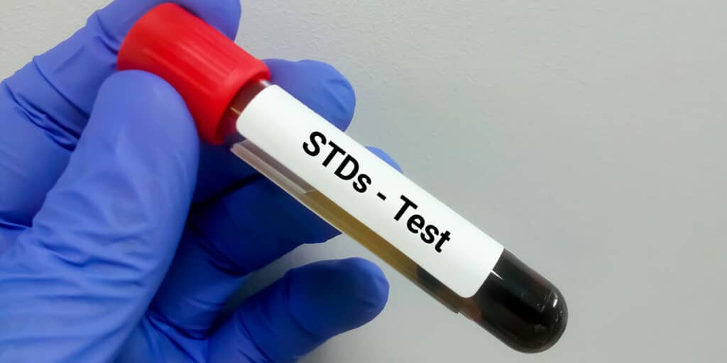 testing for std