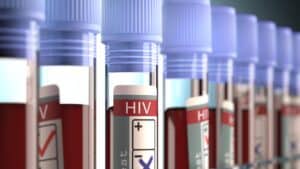 HIV test