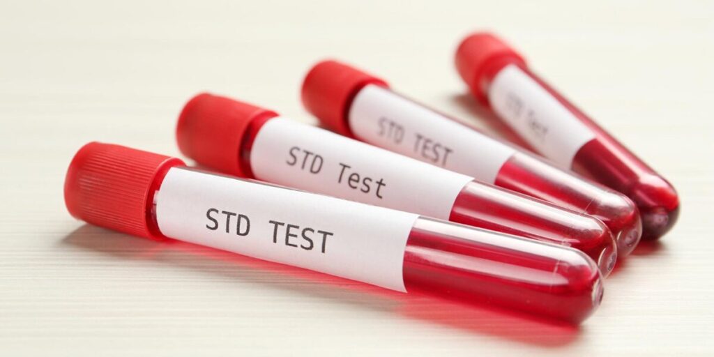 fast std testing