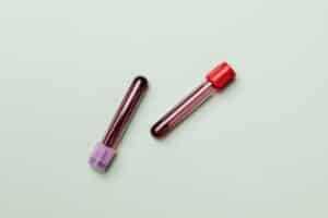 tubes of blood