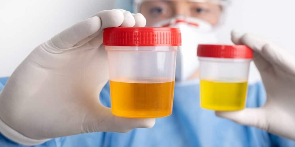 what std makes you pee blood