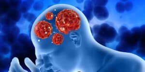 how does herpes affect the nervous system